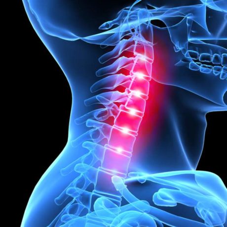 Straight Neck Syndrome: A Natural and Alternative Treatment Method - Los  Angeles Upper Cervical